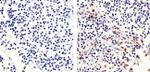 Phospho-Rb (Ser780) Antibody in Immunohistochemistry (Paraffin) (IHC (P))