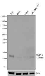 TIMP4 Antibody in Western Blot (WB)