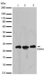 TIMP4 Antibody in Western Blot (WB)