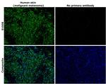 S100B Antibody in Immunohistochemistry (Paraffin) (IHC (P))