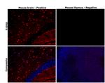 S100B Antibody in Immunohistochemistry (Paraffin) (IHC (P))