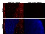 S100B Antibody in Immunohistochemistry (Paraffin) (IHC (P))