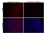 S100B Antibody