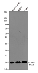 S100B Antibody in Western Blot (WB)