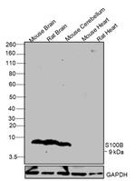 S100B Antibody in Western Blot (WB)