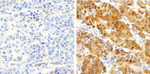 S100B Antibody in Immunohistochemistry (Paraffin) (IHC (P))