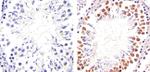 PIM1 Antibody in Immunohistochemistry (Paraffin) (IHC (P))