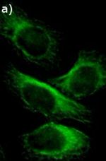 SQSTM1 Antibody in Immunocytochemistry (ICC/IF)