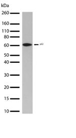 SQSTM1 Antibody in Western Blot (WB)