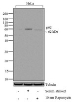 SQSTM1 Antibody in Western Blot (WB)