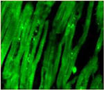 Troponin I Antibody in Immunohistochemistry (Paraffin) (IHC (P))