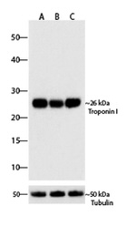 Troponin I Antibody in Western Blot (WB)