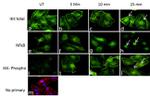 Phospho-IKK alpha/beta (Ser176, Ser180) Antibody