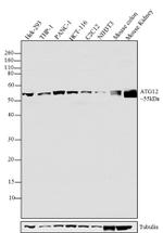 ATG12 Antibody in Western Blot (WB)