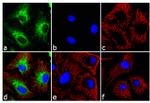 BNIP3 Antibody in Immunocytochemistry (ICC/IF)