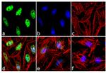 ATR Antibody in Immunocytochemistry (ICC/IF)