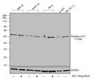 Phospho-c-Kit (Tyr703) Antibody in Western Blot (WB)