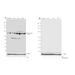 Phospho-EGFR (Tyr1086) Antibody in Western Blot (WB)