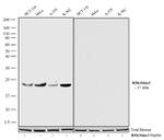 H3K36me2 Antibody in Western Blot (WB)