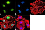 H2BK5ac Antibody in Immunocytochemistry (ICC/IF)