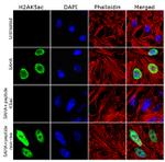 H2AK5ac Antibody in Immunocytochemistry (ICC/IF)