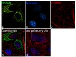 PPP2R2A Antibody in Immunocytochemistry (ICC/IF)