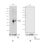 Phospho-FOXO4 (Thr28) Antibody in Western Blot (WB)