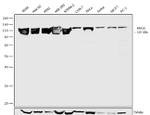 RNF20 Antibody in Western Blot (WB)