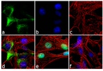 NF-H Antibody