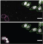 TDP-43 Antibody in Immunocytochemistry (ICC/IF)