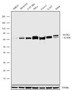 SSTR2 Antibody in Western Blot (WB)