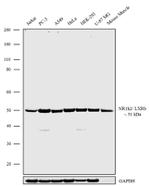 LXR beta Antibody in Western Blot (WB)