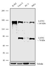 LATS1 Antibody in Western Blot (WB)