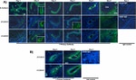 alpha Catenin Antibody in Immunohistochemistry (IHC)