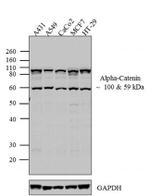 alpha Catenin Antibody in Western Blot (WB)