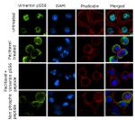 Phospho-Vimentin (Ser56) Antibody