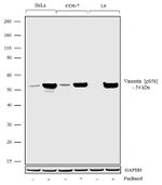 Phospho-Vimentin (Ser56) Antibody