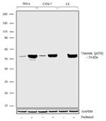 Phospho-Vimentin (Ser56) Antibody in Western Blot (WB)