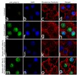 Phospho-ATF2 (Tyr69, Thr71) Antibody in Immunocytochemistry (ICC/IF)