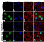 Phospho-ATF2 (Tyr69, Thr71) Antibody