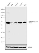 Phospho-CXCR4 (Ser324, Ser325) Antibody in Western Blot (WB)