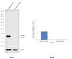 NGAL Antibody