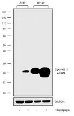 NGAL Antibody in Western Blot (WB)