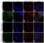 Phospho-Acetyl-CoA Carboxylase (Ser79) Antibody