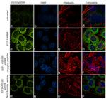 Phospho-AS160 (Ser588) Antibody in Immunocytochemistry (ICC/IF)