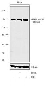 Phospho-AS160 (Ser588) Antibody in Western Blot (WB)