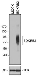 BDKRB2 Antibody in Western Blot (WB)