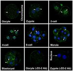 ZO-2 Antibody in Immunohistochemistry (IHC)