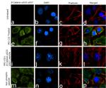 Phospho-beta Catenin (Ser33, Ser37) Antibody in Immunocytochemistry (ICC/IF)