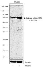 Phospho-beta Catenin (Ser33, Ser37) Antibody in Western Blot (WB)